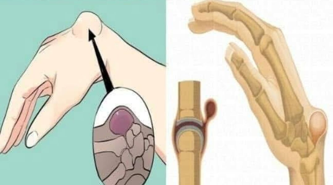 This lump can appear due to something you do every day